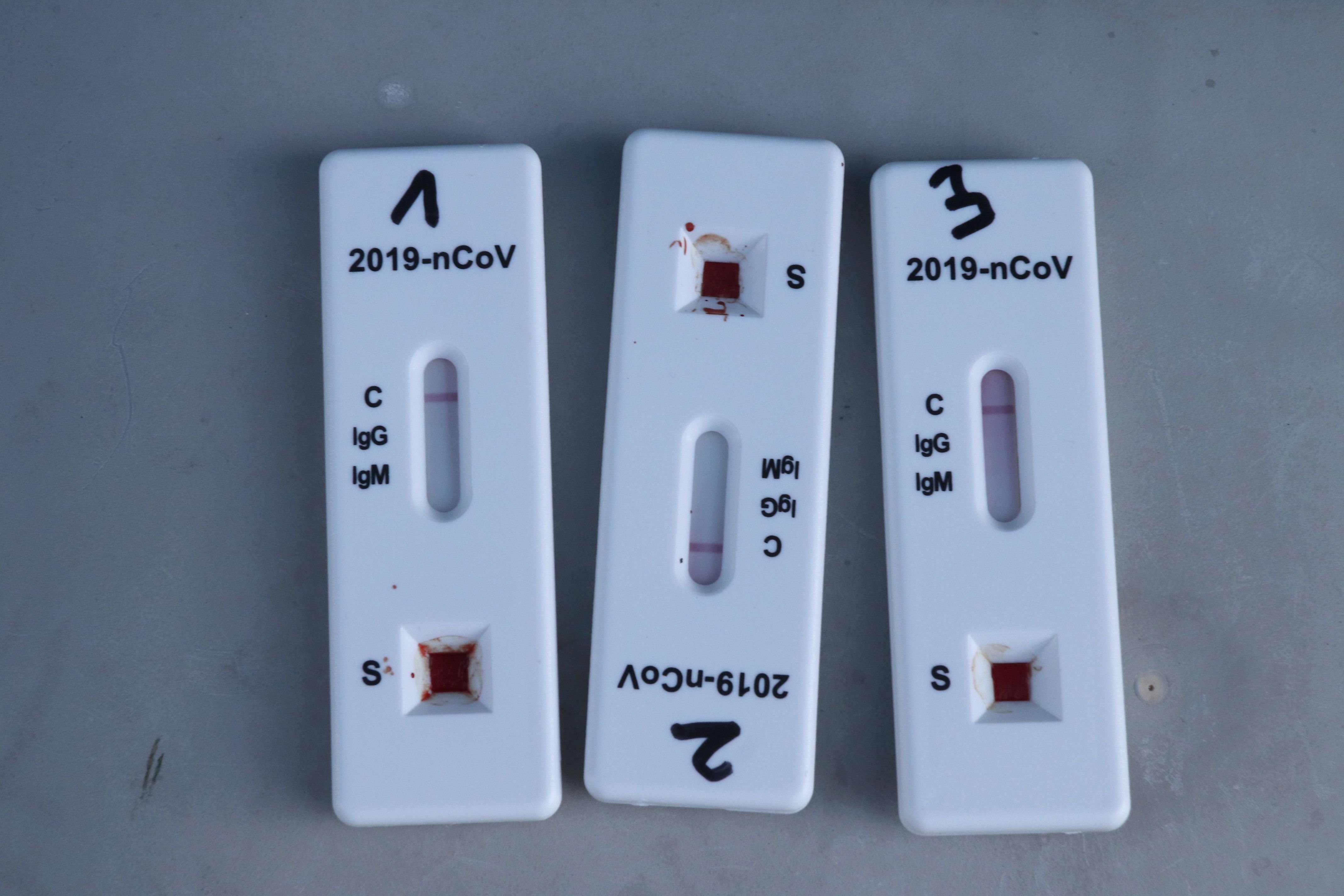 Se Aprueba La Venta De Tests De Antígenos En Las Farmacias Sin Receta 3035